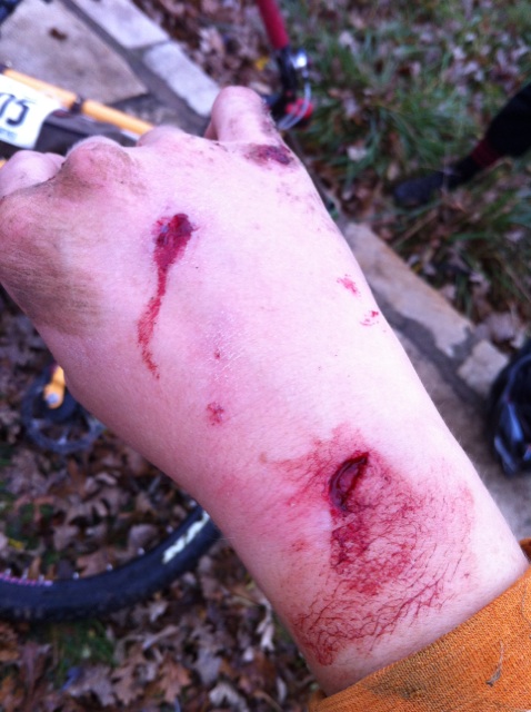 Downward view of a person's hand and wrist with bloody cuts on it, over a bike on the ground