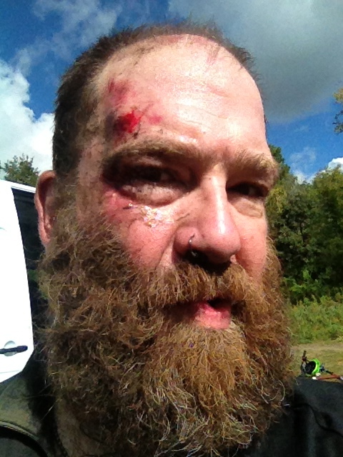 Headshot of a person with a beard and a bloody scrape above their right eye