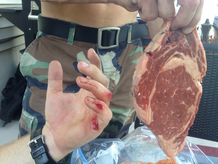 A hand with an injury, and the hand of a person wearing camo pants holding a steak next to it