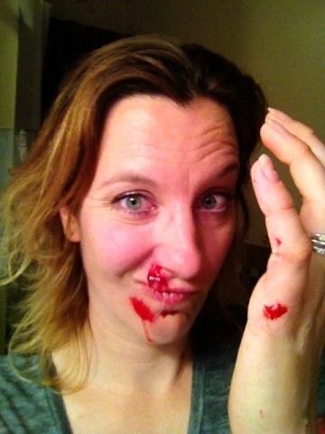 Headshot of a person, with a bloody nose and chin, holding up a their left hand to show an injury